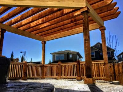 Pergola Roofing Services